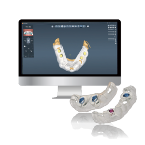 技工用作成ソフト　Dentiq Guide Creator